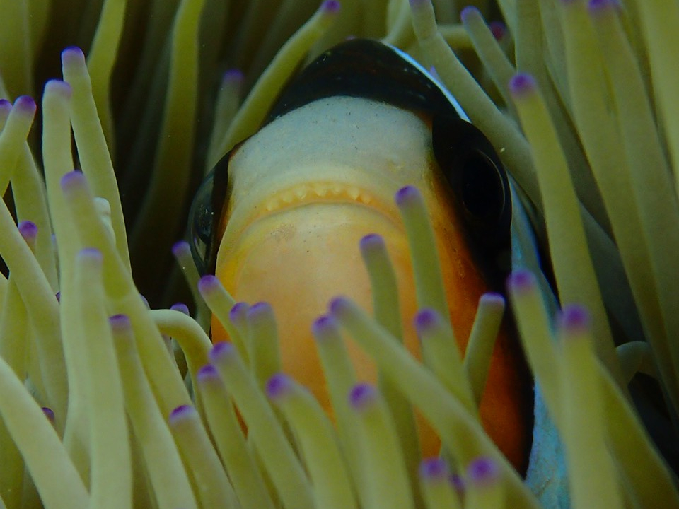 C̐lCҁN}m~ڂ̑OŌꂿႤI