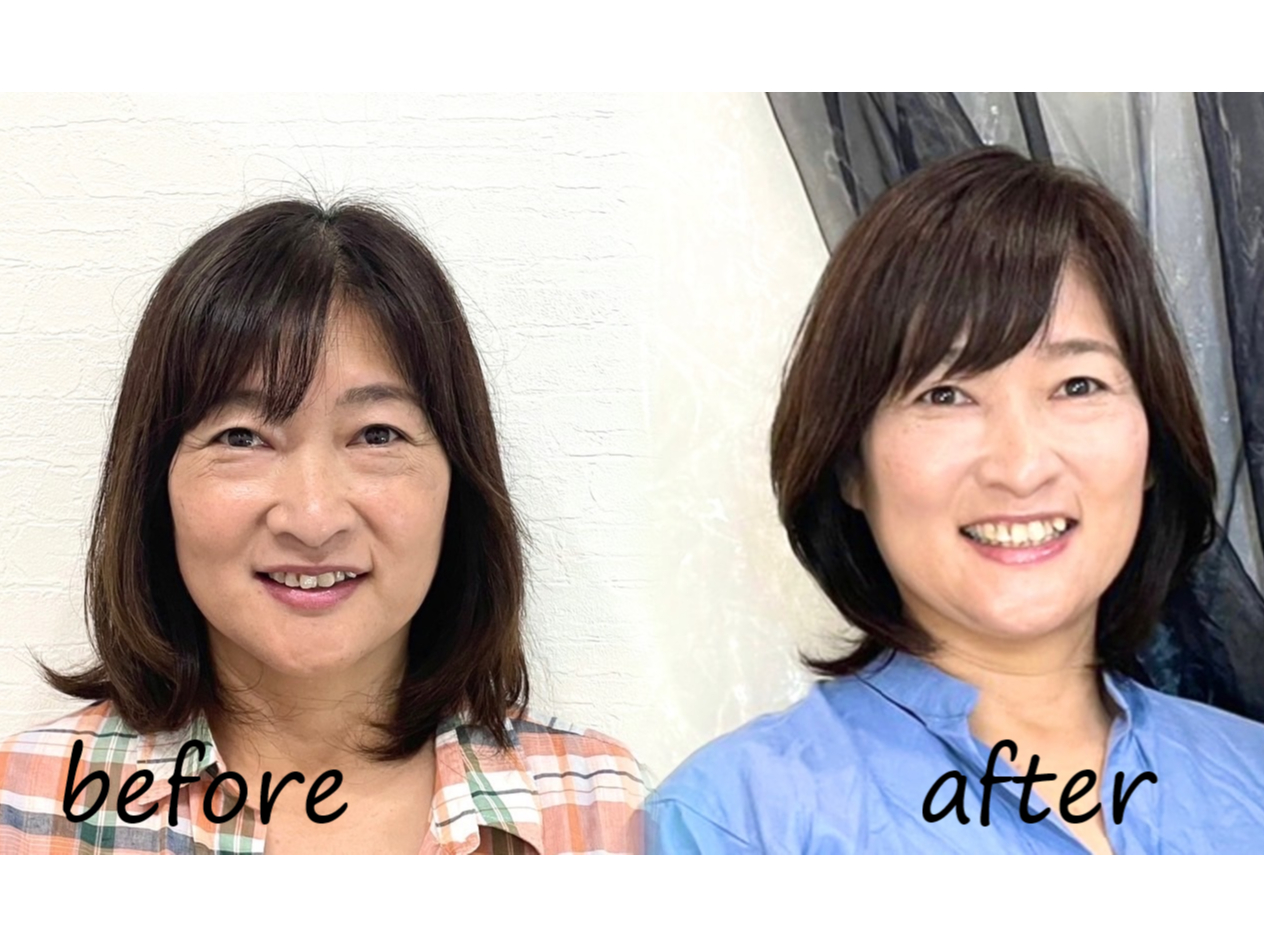 `AFAwACNAhoCXłȂɃC[WAbvłł