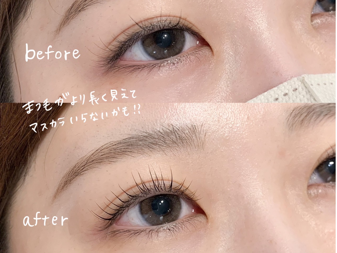 ビフォーアフター