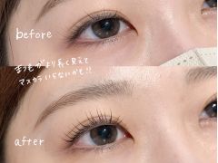 ビフォーアフター