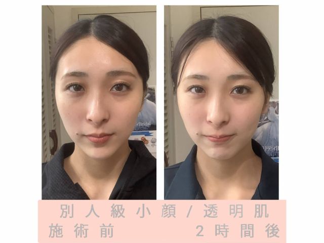 【本当の小顔は内側から♪】2時間で小顔体験◎お顔のむくみを解消し、体内デトックス&小顔リンパケアで持続するリフトアップ小顔・デカ目・全身透明美白肌叶います★