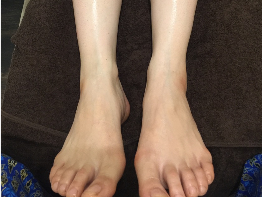 ���ڌ�͂ނ��݂����ăX�b�L���I