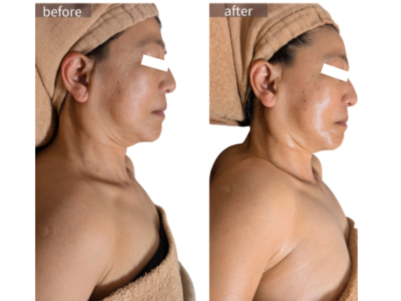 ���ʎʐ^���