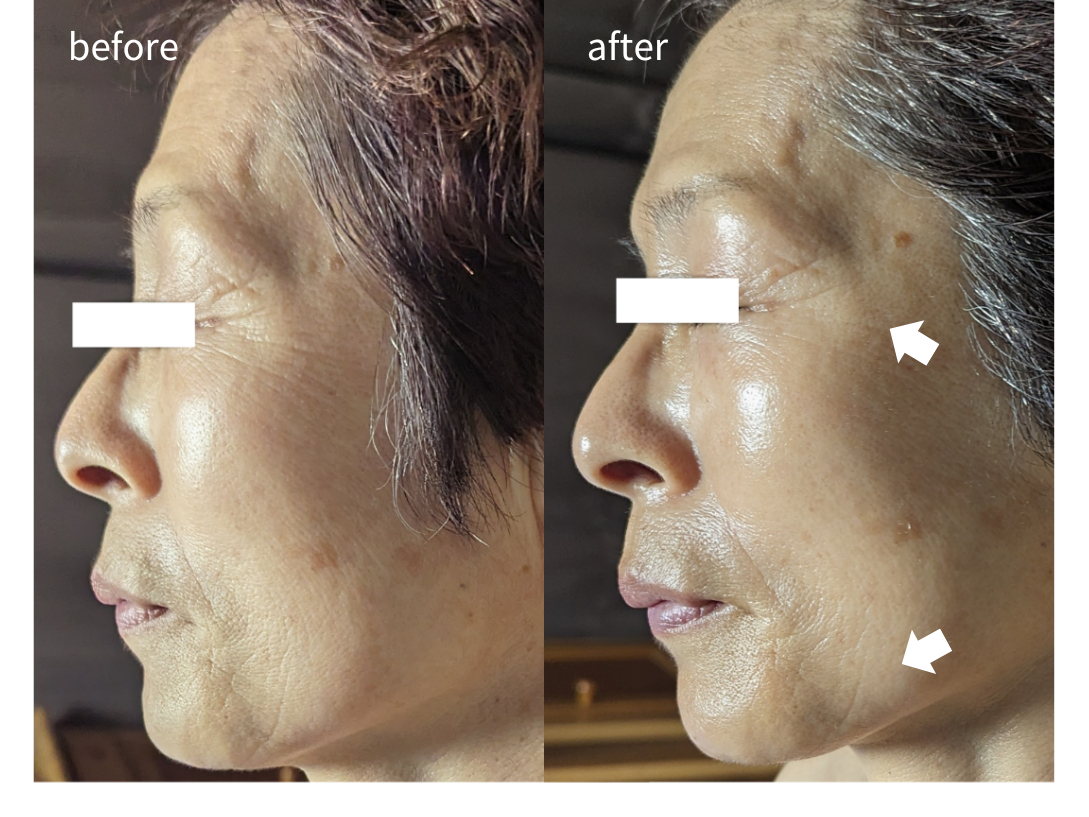 ���ʎʐ^���