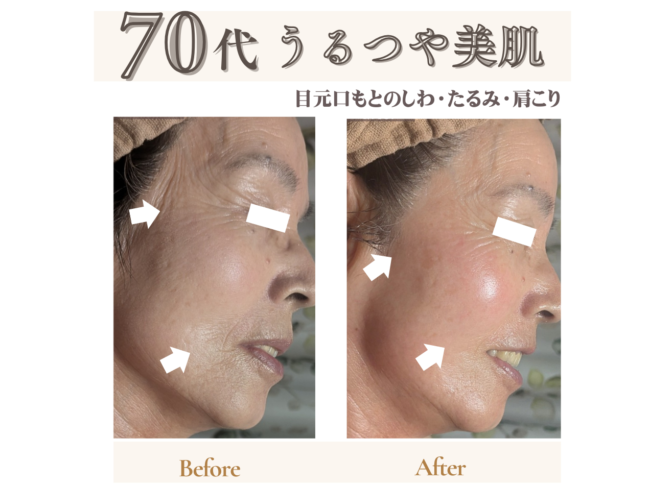 ���ʎʐ^���