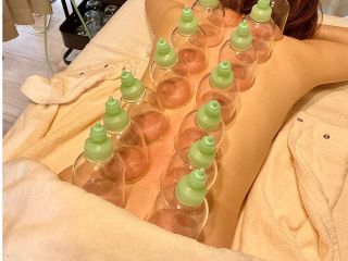 カッピングで血液の滞りを吸引し、血液循環の改善を図ります!筋肉にも刺激を与えるので筋緊張が緩和し体内の新陳代謝も促進されます。