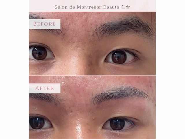 中学生のワックスアイブロウ。眉毛のつながりも綺麗になります。